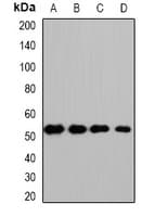 Polyclonal Rabbit anti-Human HS1BP3 Antibody (IHC, WB)