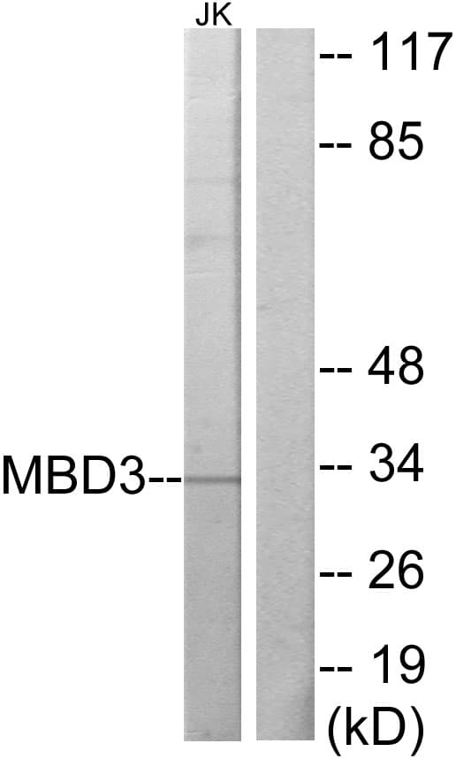 Polyclonal Rabbit anti-Human MBD3 Antibody (aa221-270, WB)