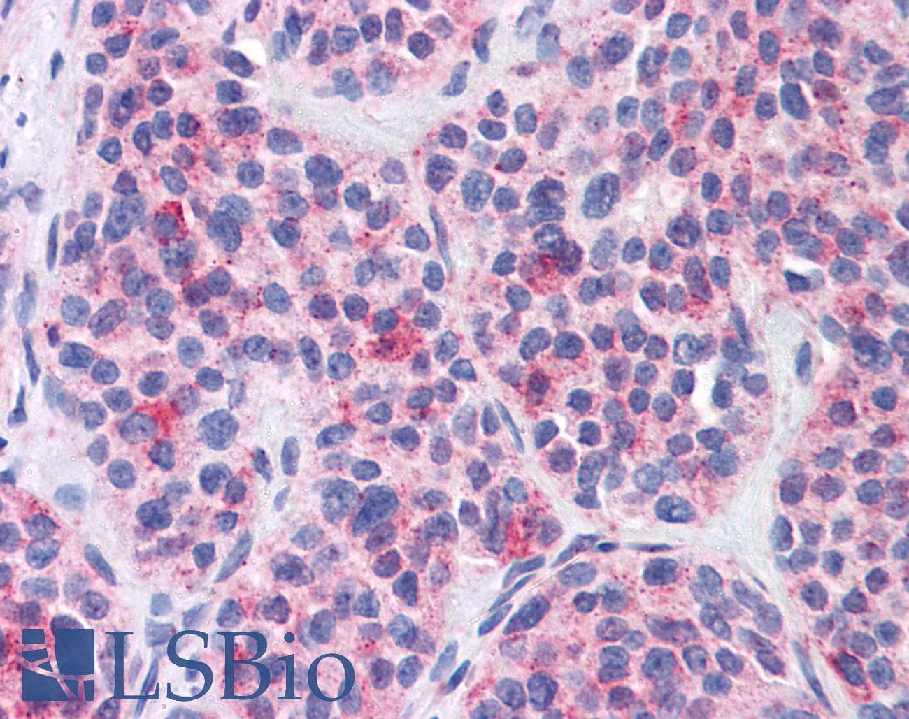 IHC-plus™ Polyclonal Rabbit anti-Human FKSG89 / MBOAT4 Antibody (Internal, IHC)