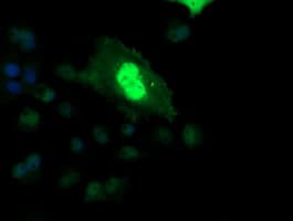ETS2 Antibody (aa90-349, clone OTI2A3, Carrier-free)