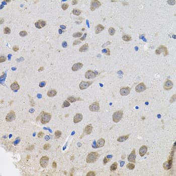 VEPH1 Antibody
