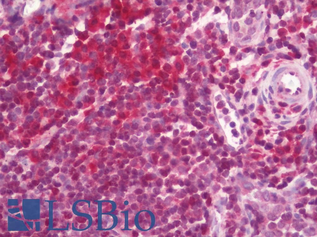 IHC-plus™ RPSA / Laminin Receptor Antibody (aa166-215)