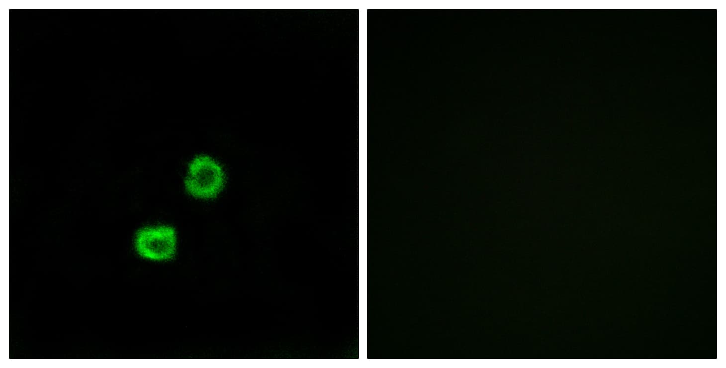 Polyclonal Rabbit anti-Human GCNT7 Antibody (aa311-360, IHC, IF, WB)