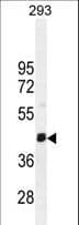 Polyclonal Rabbit anti-Human SERTAD4 Antibody (aa265-293, IHC, WB)