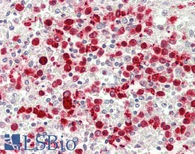 IHC-plus™ RNASE3 Antibody (aa124-151)
