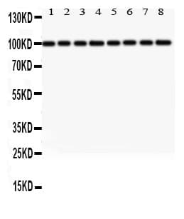 Polyclonal Rabbit anti-Human MTDH / Metadherin Antibody (aa101-270, IHC, WB)