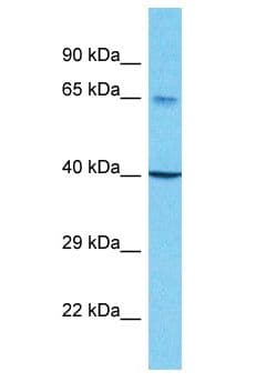 SCNN1B / ENaC Beta Antibody (aa523-572)