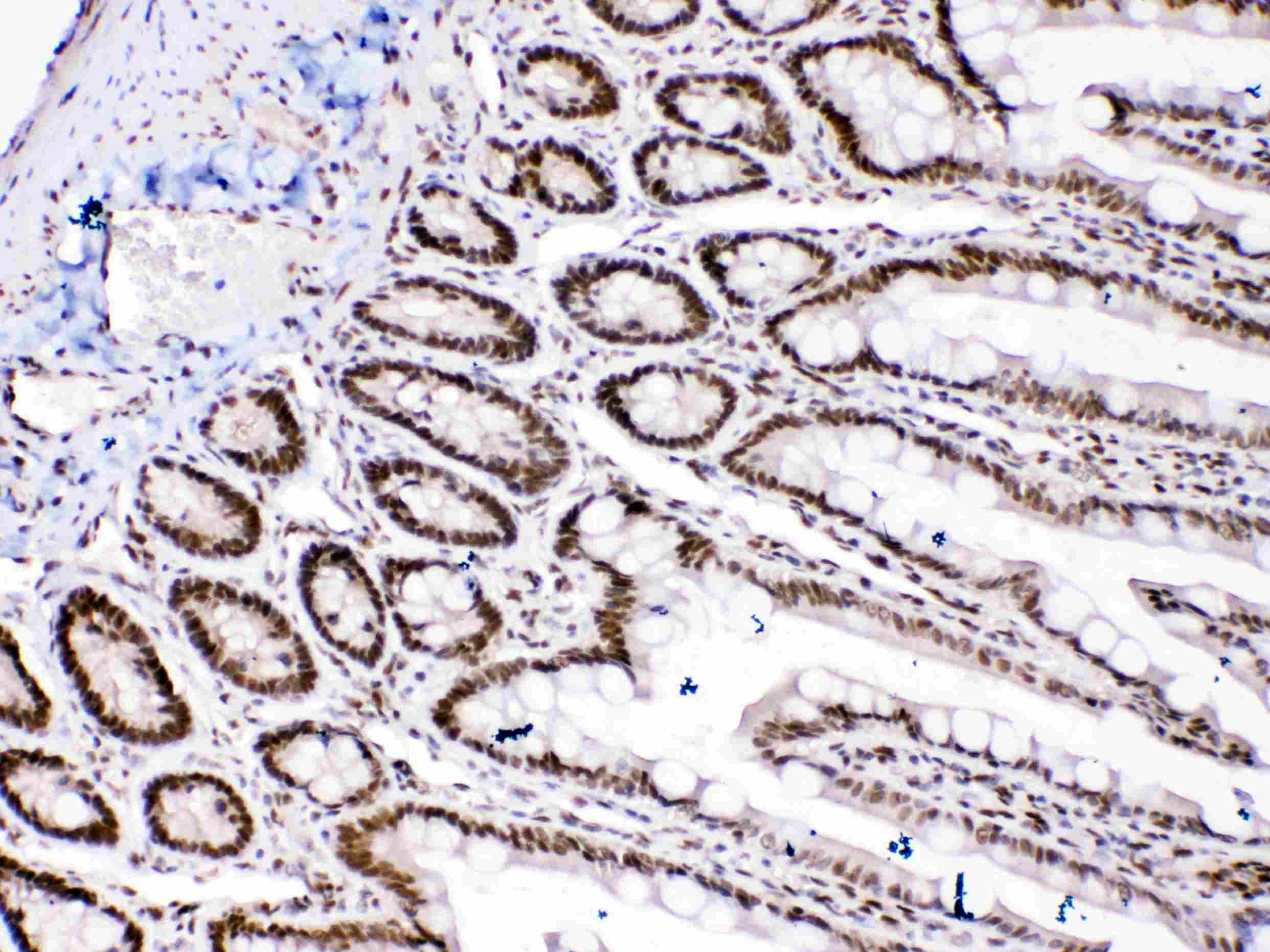 HMG1 / HMGB1 Antibody