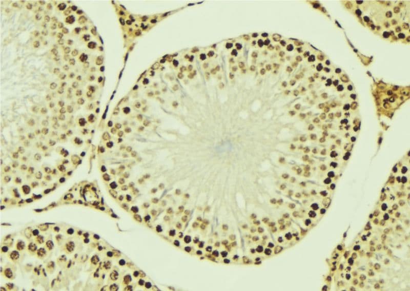 Polyclonal Rabbit anti-Human TIP48 / RUVBL2 Antibody (IHC, IF, WB)