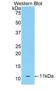 APOC3 / Apolipoprotein C III Antibody (aa21-101)