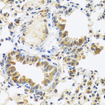 C8orf4 Antibody