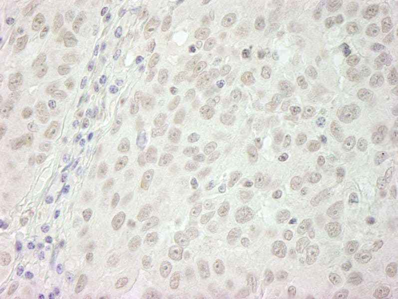 BUB1B / BubR1 Antibody (aa1-50)