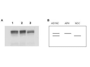 PathPlus™ Polyclonal Rabbit anti-Human MCM2 Antibody (aa15-40, IHC, WB)
