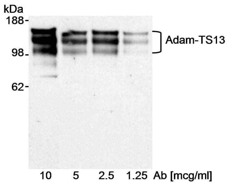 IHC-plus™ ADAMTS13 Antibody (aa250-350)