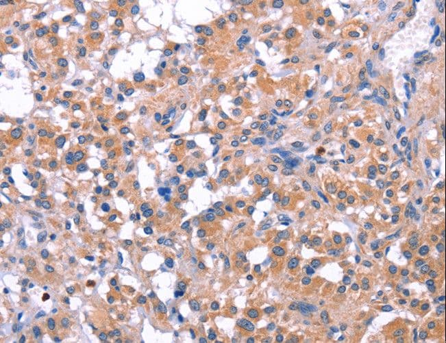Polyclonal Rabbit anti-Human ELP2 / STATIP1 Antibody (IHC)