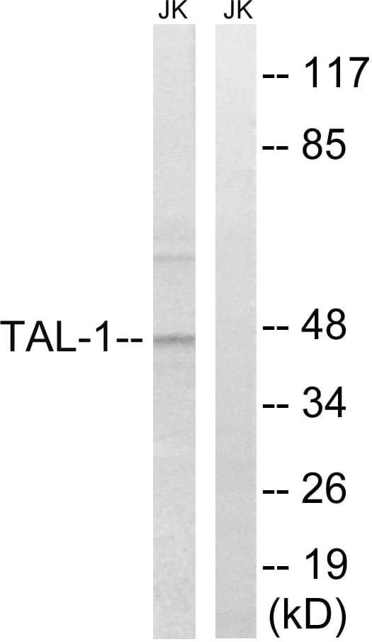 TAL1 Antibody (aa96-145)