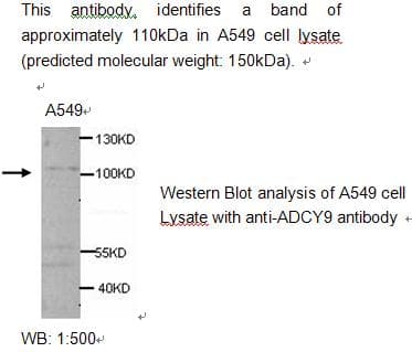 Polyclonal Rabbit anti-Human ADCY9 / Adenylate Cyclase 9 Antibody (WB)