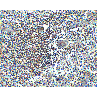 Polyclonal Rabbit anti-Human CXCR4 Antibody (IHC, IF, WB)