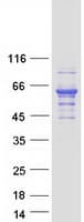 Human TH / Tyrosine Hydroxylase Protein (Recombinant Myc-DDK (Flag))