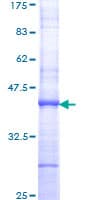 Human TBP / GTF2D Protein (Recombinant GST, N-terminus)
