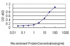 TFEB Antibody (clone S1)