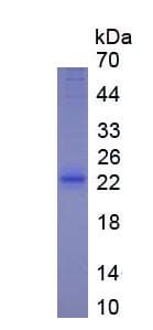 Rat IL10RA Protein (Recombinant)