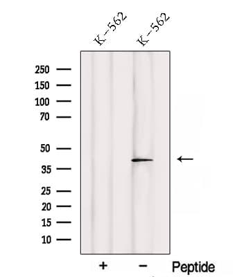 Polyclonal Rabbit anti-Human SAMSN1 Antibody (WB)
