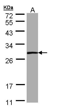 IHC-plus™ Polyclonal Rabbit anti-Human PSPH Antibody (aa1-175, IHC, WB)