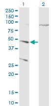 IHC-plus™ CTSD / Cathepsin D Antibody (clone 3F12-1B9)