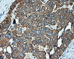 SRR / Serine Racemase Antibody (clone OTI2E3)