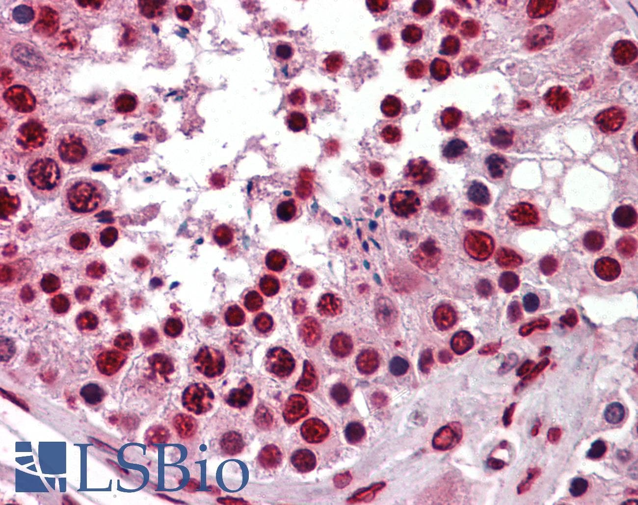 IHC-plus™ Monoclonal Mouse anti-Human KHSRP / FBP2 Antibody (clone 4C10, IHC, WB)