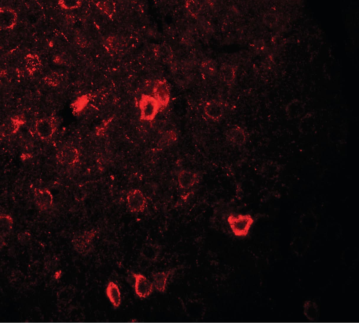 IHC-plus™ Polyclonal Rabbit anti-Human CNRIP1 Antibody (IHC, IF, WB)