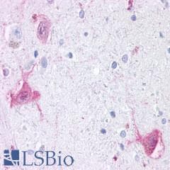 PathPlus™ Polyclonal Rabbit anti-Human GPR6 Antibody (Cytoplasmic Domain, IHC)