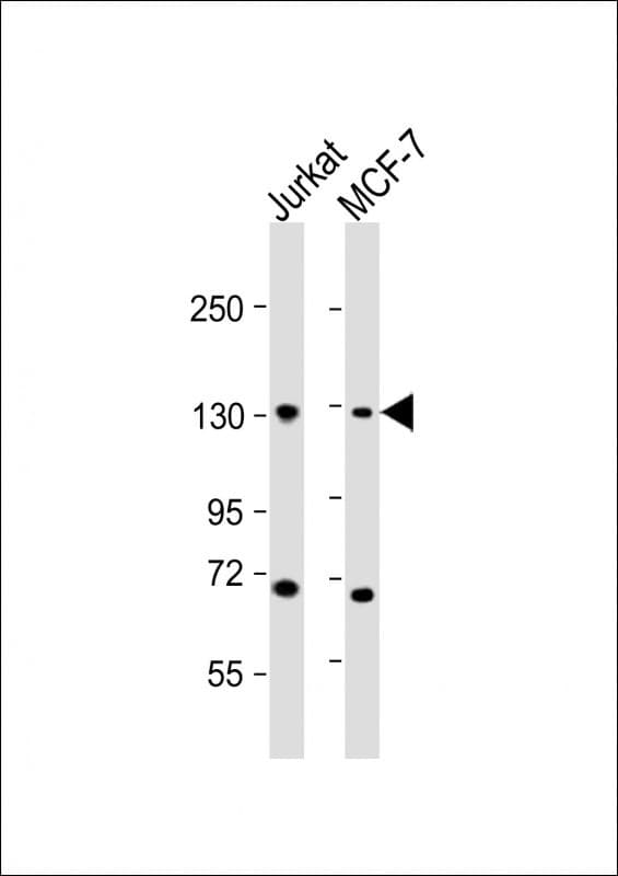 Polyclonal Rabbit anti-Human CTCF Antibody (aa334-364, IHC, WB)