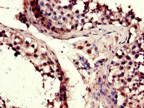 ERIC-1 / TACC3 Antibody