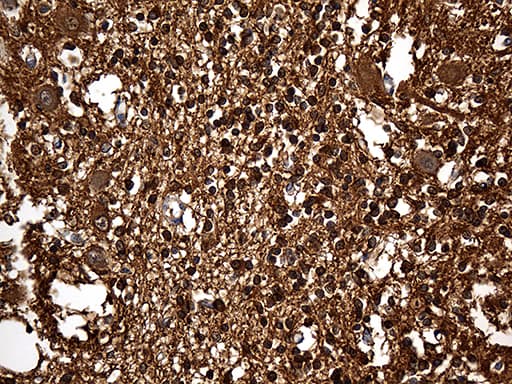 GDI1 Antibody (clone OTI1B1)