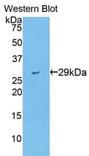 TTN / Titin Antibody (aa33779-34025)