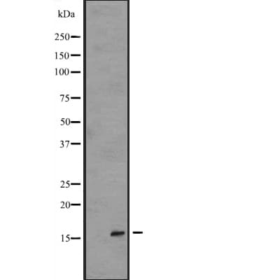 Polyclonal Rabbit anti-Human IL36RN / IL1F5 Antibody (WB)