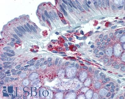 IHC-plus™ MAC-2-BP / LGALS3BP Antibody (clone 1C2)