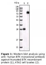 Monoclonal Mouse anti-Human BTK Antibody (clone 7F12H4, IHC, IF, WB)