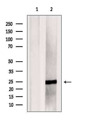 Polyclonal Rabbit anti-Human ILEI / FAM3C Antibody (WB)