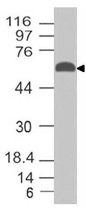 EIF2AK2 / PKR Antibody