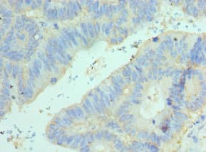 ELF4 / MEF Antibody (aa1-200)