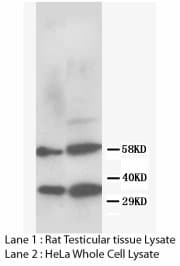 RAD51 / RECA Antibody (N-Terminus, Sepharose)