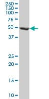 Monoclonal Mouse anti-Human FBXL3 Antibody (clone 1A3, WB)