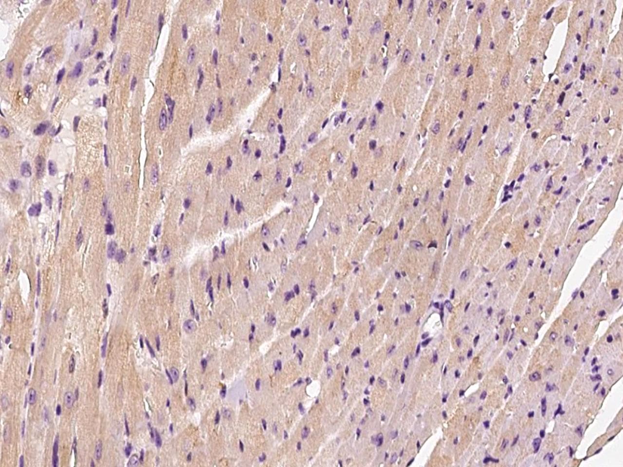HSPB8 / H11 / HSP22 Antibody