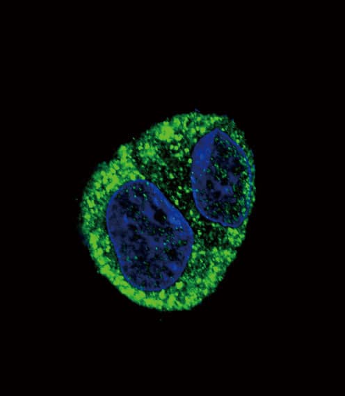FGA / Fibrinogen Alpha Antibody (aa116-144)