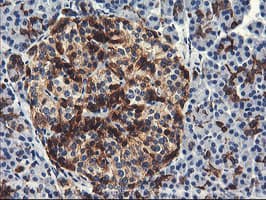 PFKP Antibody (clone OTI1F2)