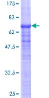 Human TDP2 / TTRAP Protein (Recombinant GST)