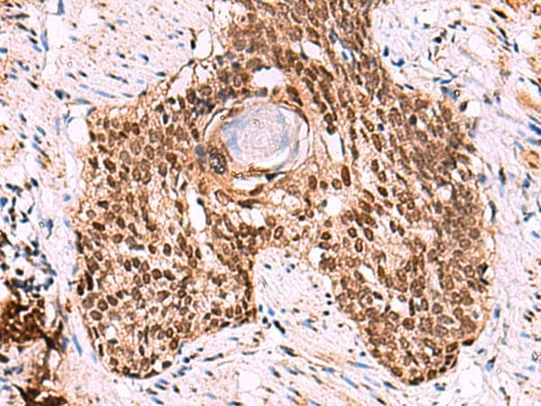 Polyclonal Rabbit anti-Human LDB1 / CLIM2 Antibody (IHC, WB)